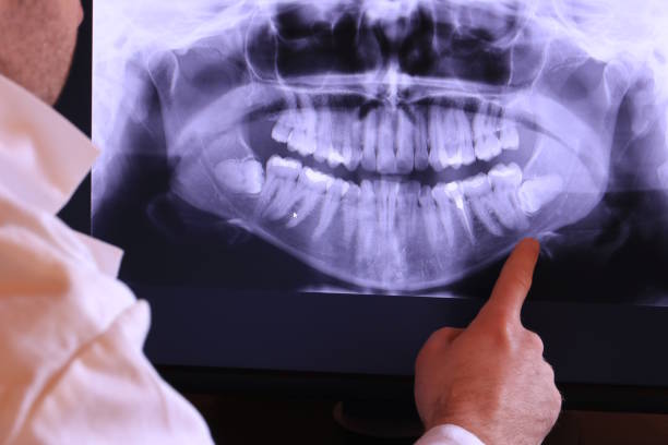 Best Emergency Dentist for Knocked-Out Tooth in Rainelle, WV