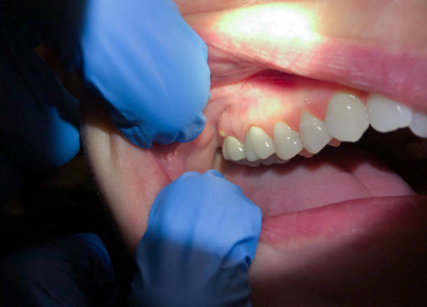 Professional Emergency Dentist in WV